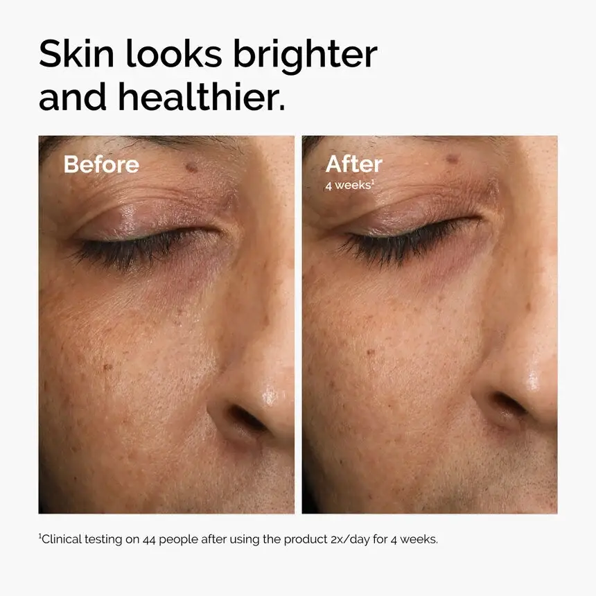 Multi-Antioxidant Radiance Serum's photo #3