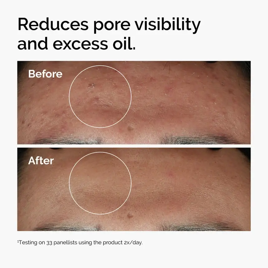 The Ordinary Niacinamide 10% + Zinc 1% (30 ml) — imagen 3