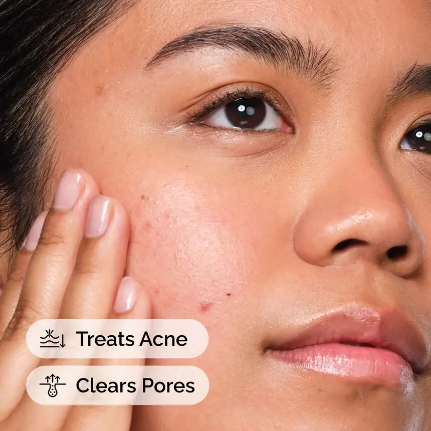 The Ordinary Salicylic Acid 2% Solution (30 ml) — imagen 2