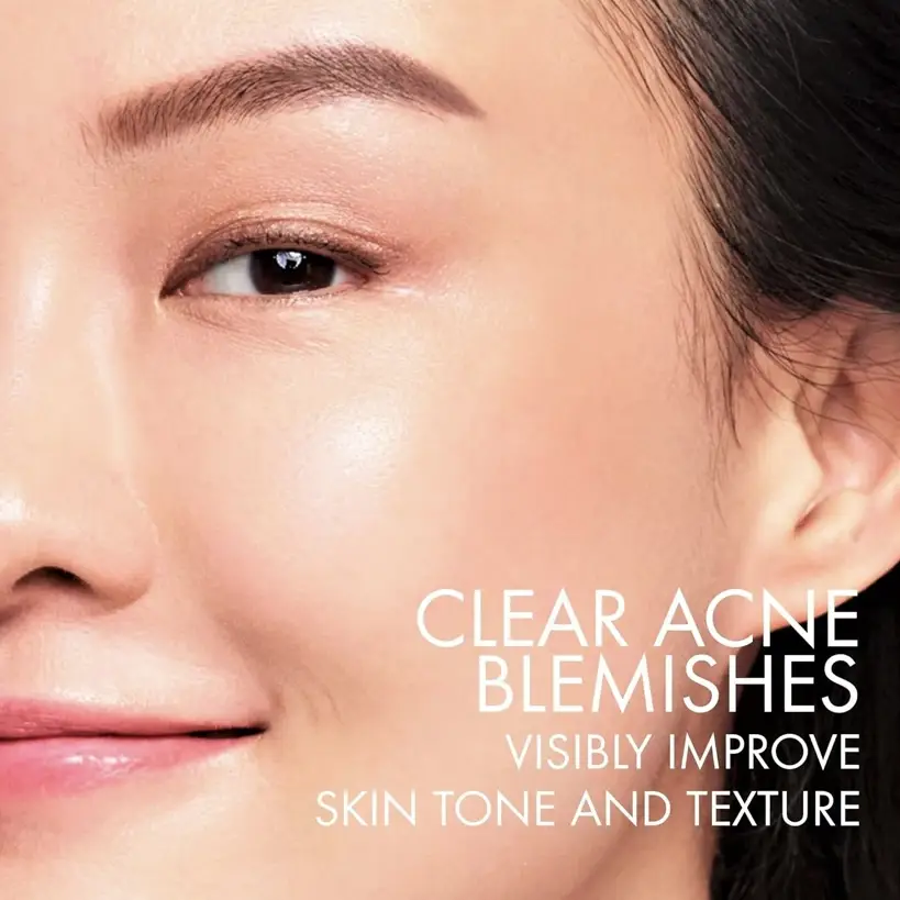 VICHY Crema hidratante diaria Normaderm Acne Control's photo #4