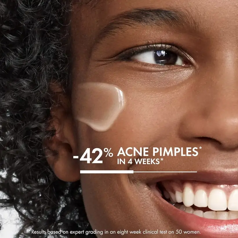 VICHY Crema hidratante diaria Normaderm Acne Control's photo #1