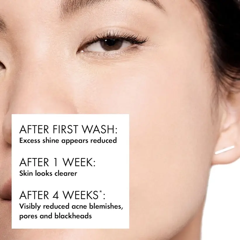 Vichy Normaderm - Limpiador facial diario para acné con ácido salicílico.'s photo #1