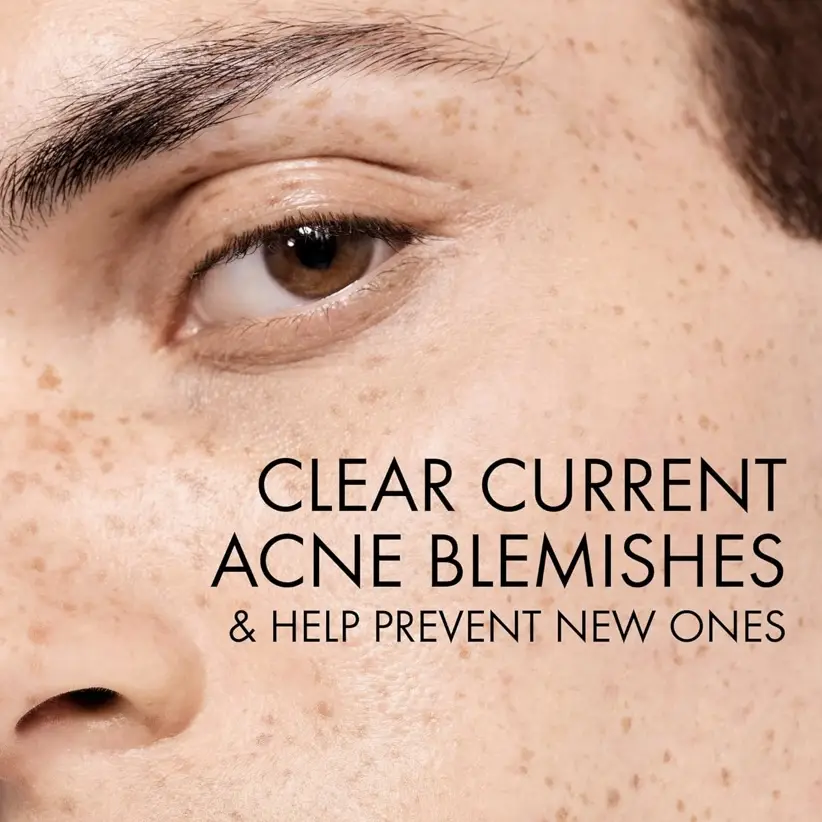 Vichy Normaderm - Limpiador facial diario para acné con ácido salicílico.'s photo #5