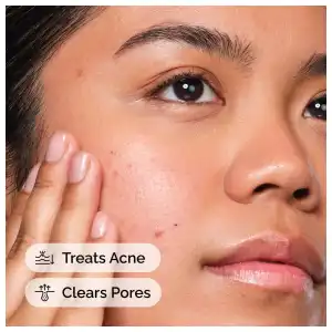 The Ordinary Salicylic Acid 2% Solution (30 ml) miniatura 2