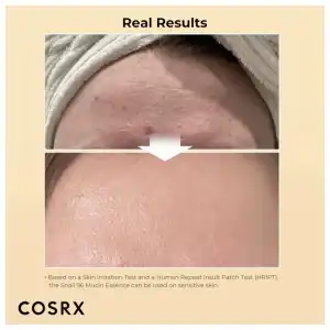 Cosrx Advanced Snail 96 Esencia de mucina 3.38 fl oz miniatura 3