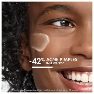 VICHY Crema hidratante diaria Normaderm Acne Control miniatura 2